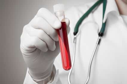 How to Beat and Get Out of a Blood Test DUI Case - DUI Blood Test ...